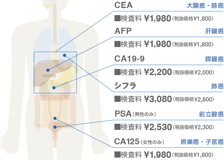 腫瘍マーカー検査価格表